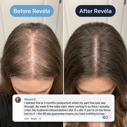 Revéla Hair Recovery